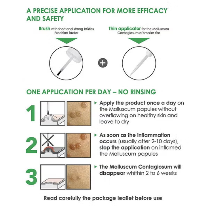 ACM Molutrex 5% Topical Solution 3ML