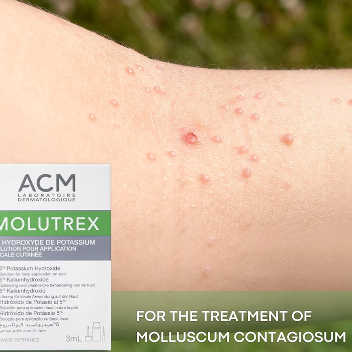 ACM Molutrex 5% Topical Solution 3ML
