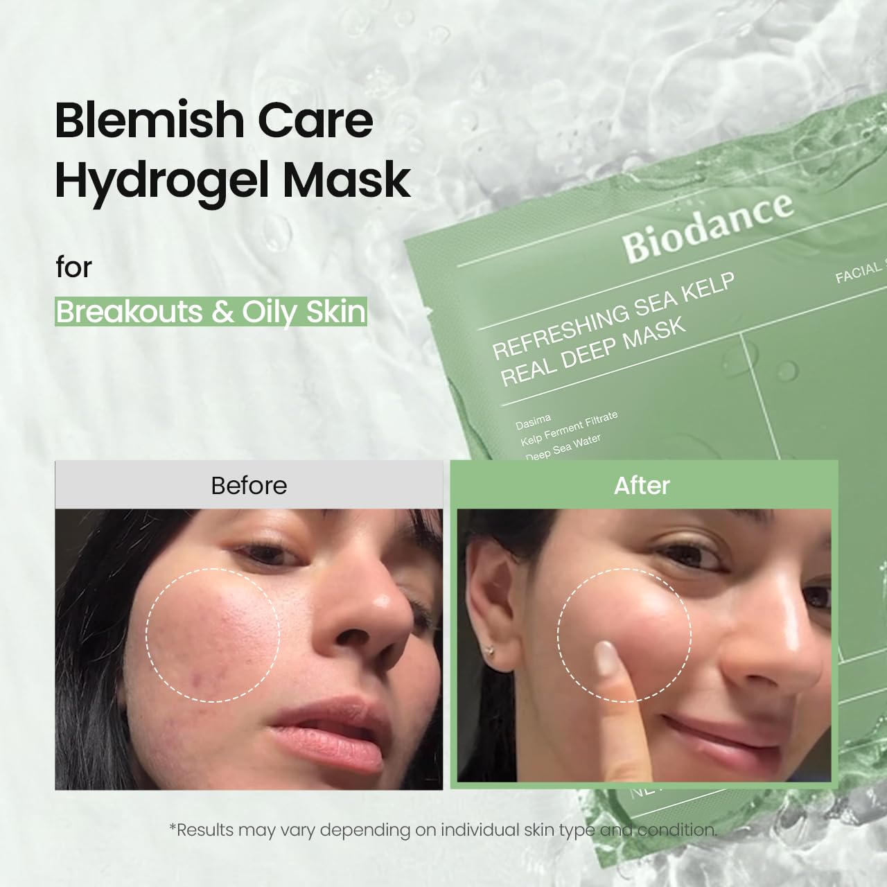 Biodance Refreshing Sea Kelp Real Deep Hydrogel Sheet Mask, Calming, Soothing and Oil Control, 34g