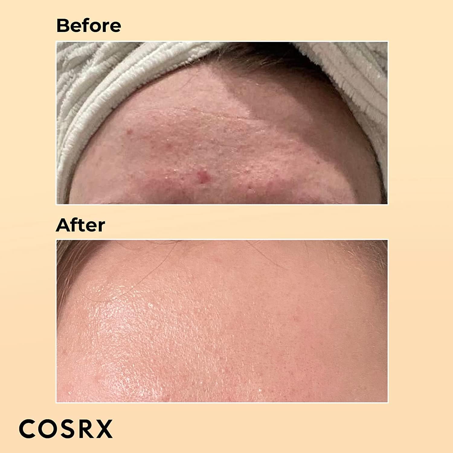 Cosrx Advanced Snail 96 Mucin Power Essence 100ml