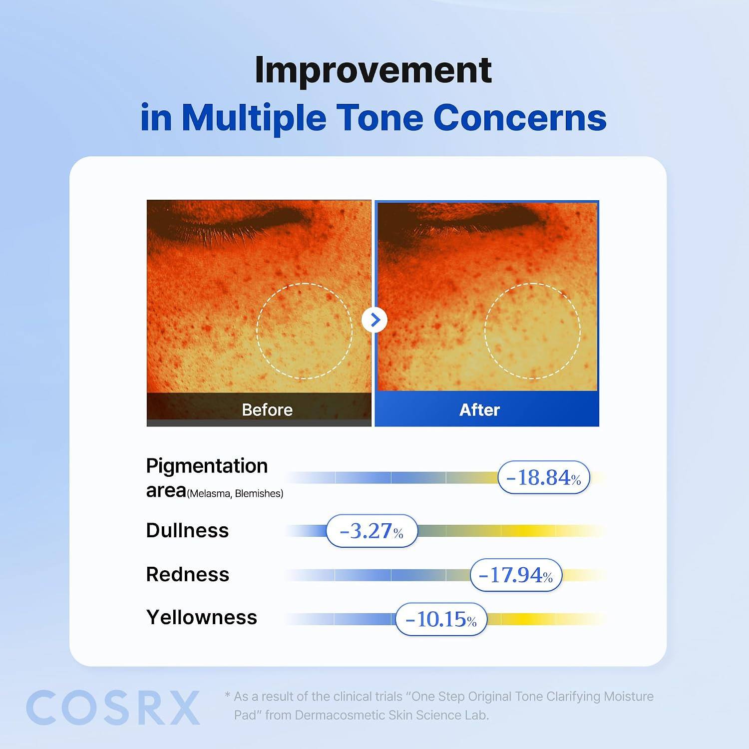 CosRx One Step Original Tone Clarifying Pad 230ml 100's