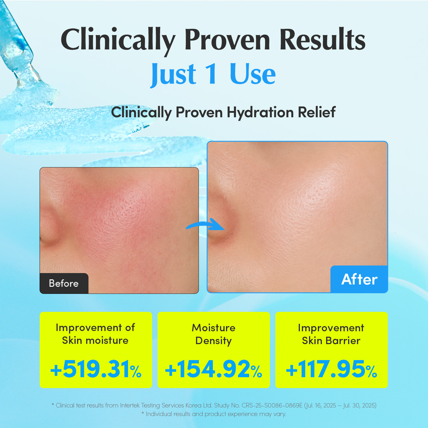 Eqqualberry Hyaltoin Flooding Serum 30ML