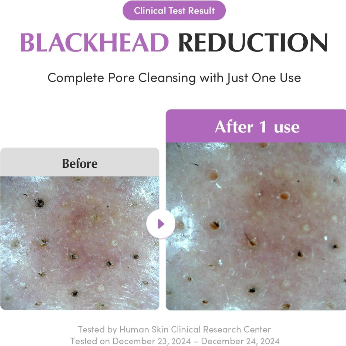 Eqqualberry Purple Rice Pore Purifying Pack Cleanser 130G