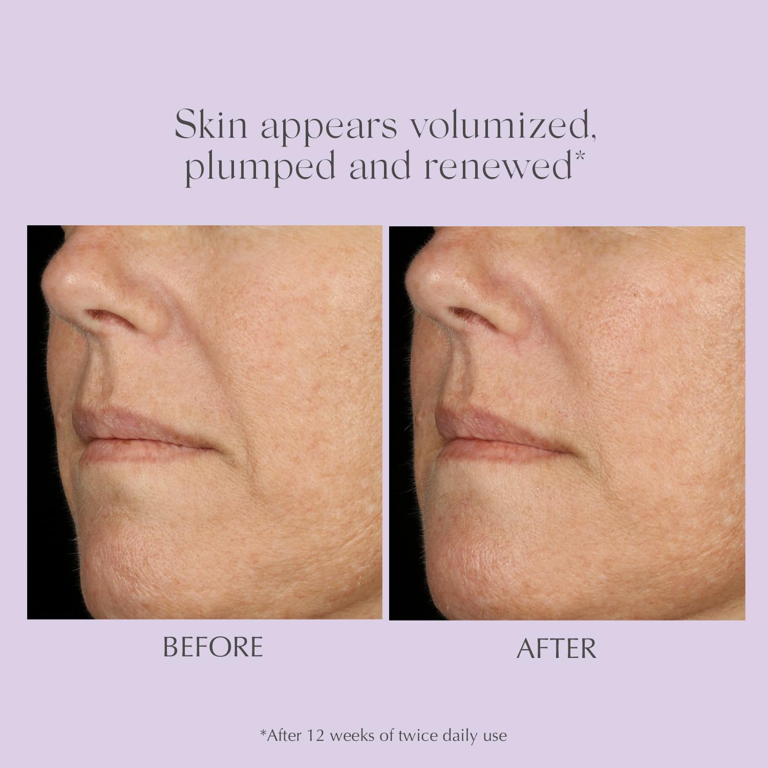 Exuviance Professional Total Correct Serum 30 ml