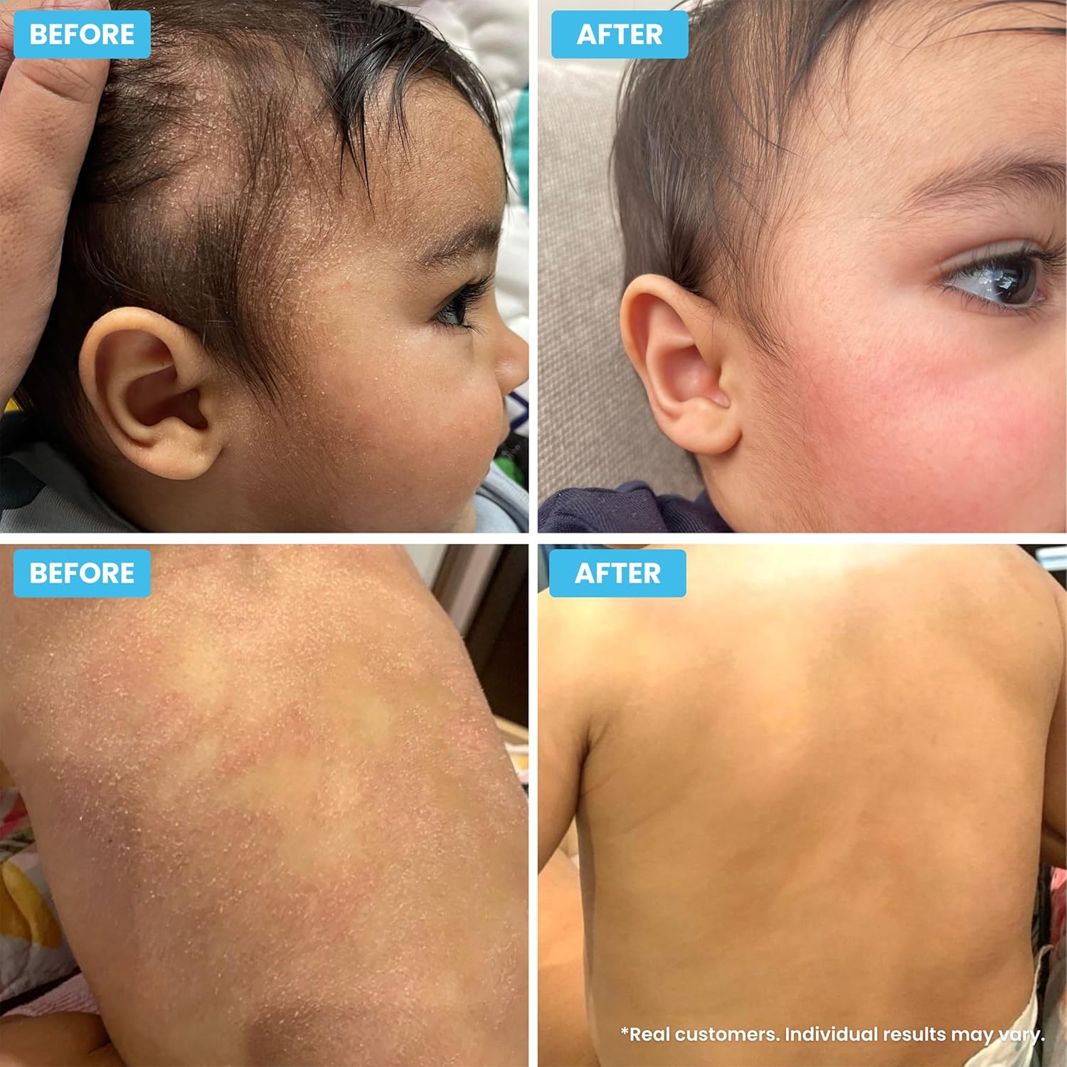 زيت الاستحمام و اكزيما الجسم للأطفال من جراهامز ناتشرال 100مل