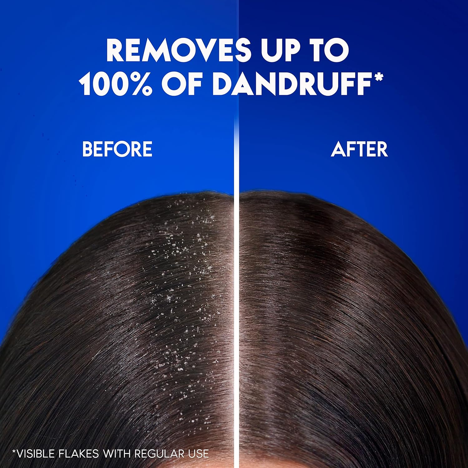 Head & Shoulders Daily Clean Shampoo 200ml