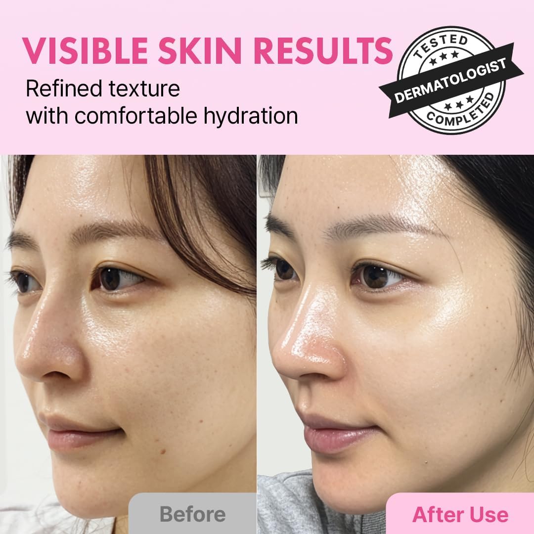 Hanskin Hyaluron Exfoliating AHA Treatment 150ml