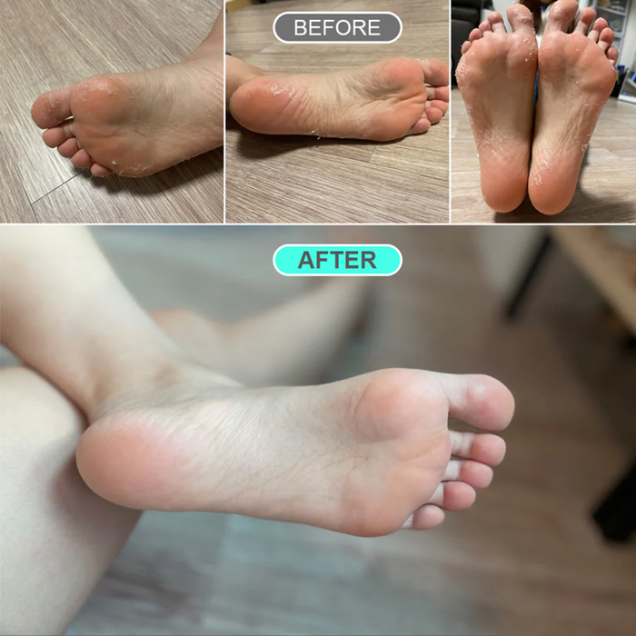 Kocostar Premium Foot Peeling Pack Large 50ml 1s