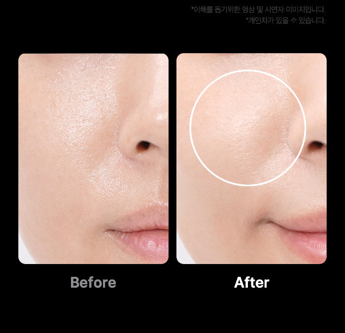 ميديكوب إيج-آر بوستر برو جهاز الوجه الأسود، معزز البشرة بالليد للامتصاص والعناية بالمسام والإشراقة