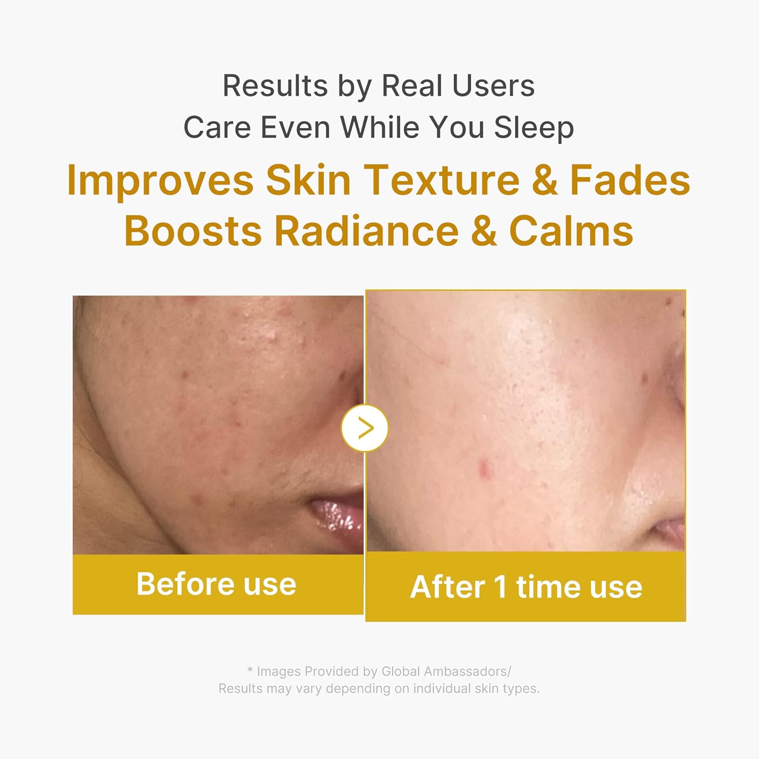 Medicube Kojic Acid Turmeric Night Wrapping Mask, Overnight Brightening and Texture Care, 75ml