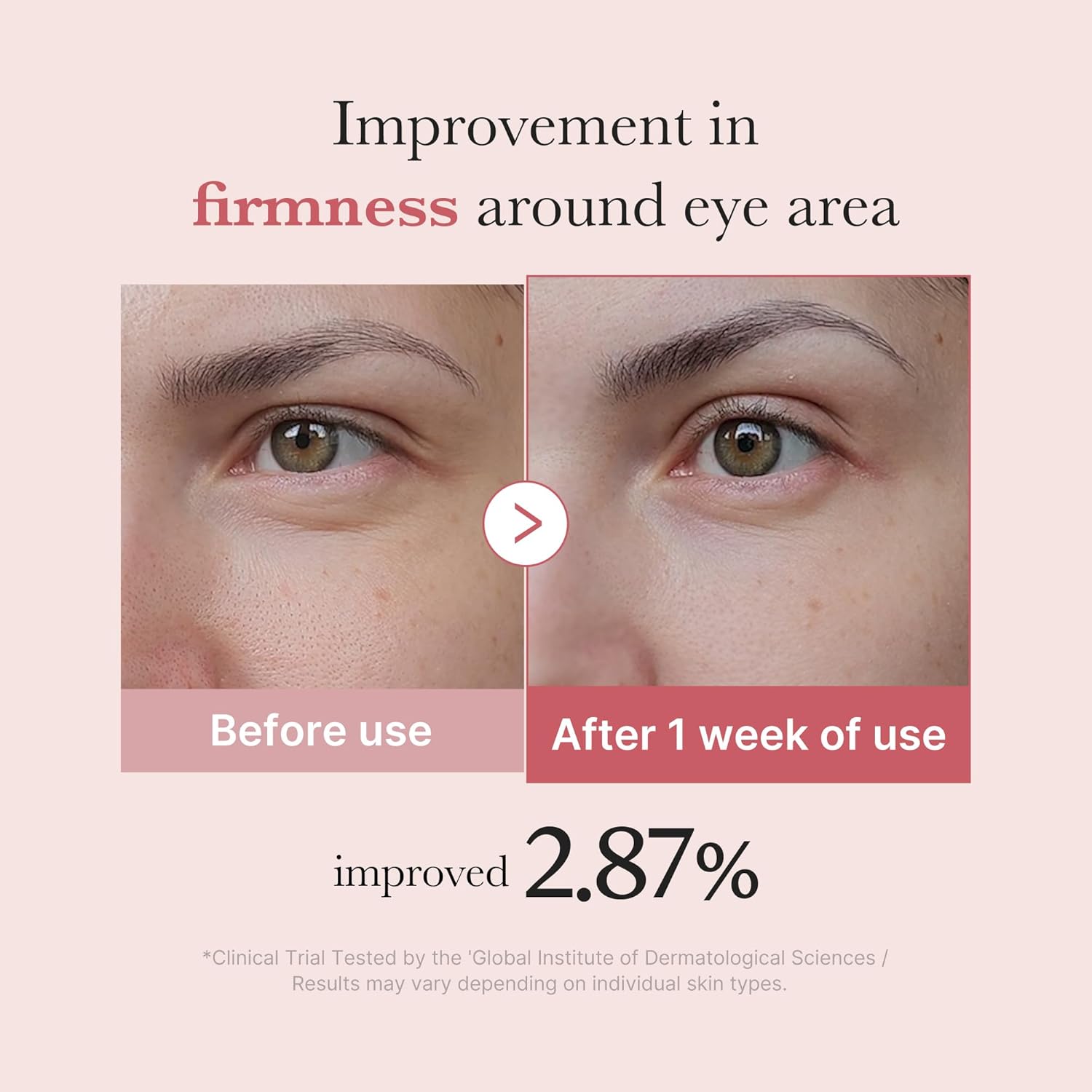 Medicube PDRN Pink Peptide Eye Cream, Retinol Care for Wrinkles, Dark Circles and Firm, 30ml