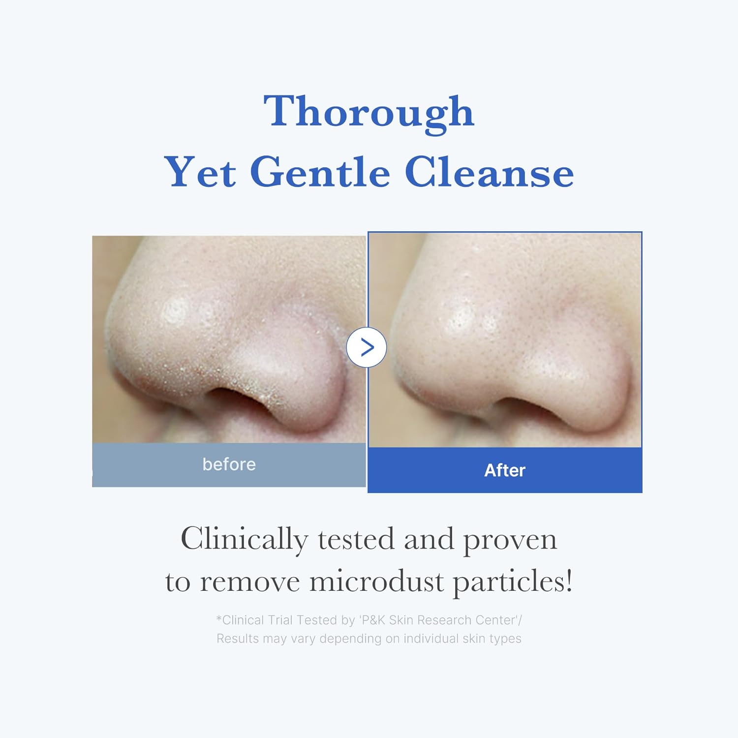 Medicube Zero Foam Cleanser, Microdust Deep Cleanse, Low-Irritation Pore Care Face Wash, 120ml