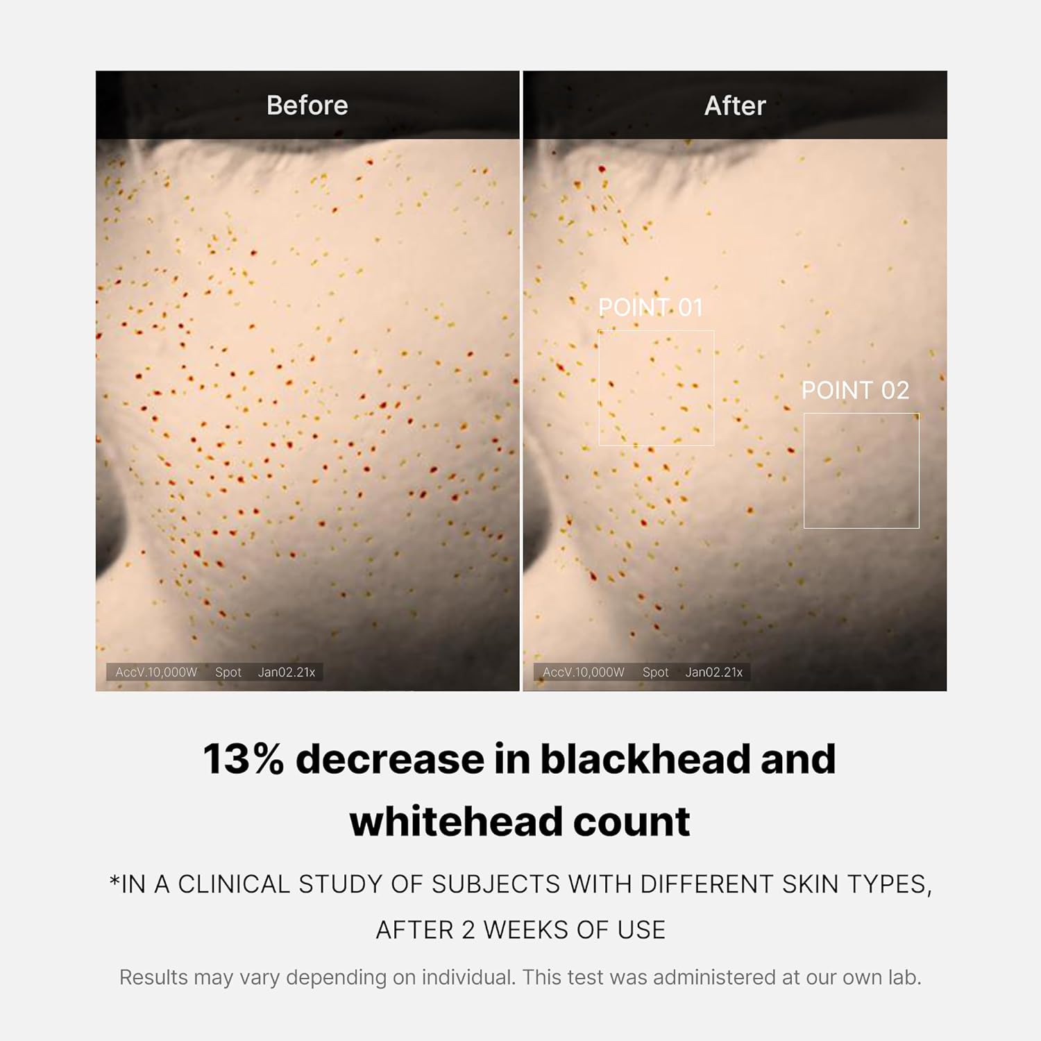Medicube Zero Pore One Day Serum, AHA BHA PHA Exfoliating for Pore Tightening, 30ml