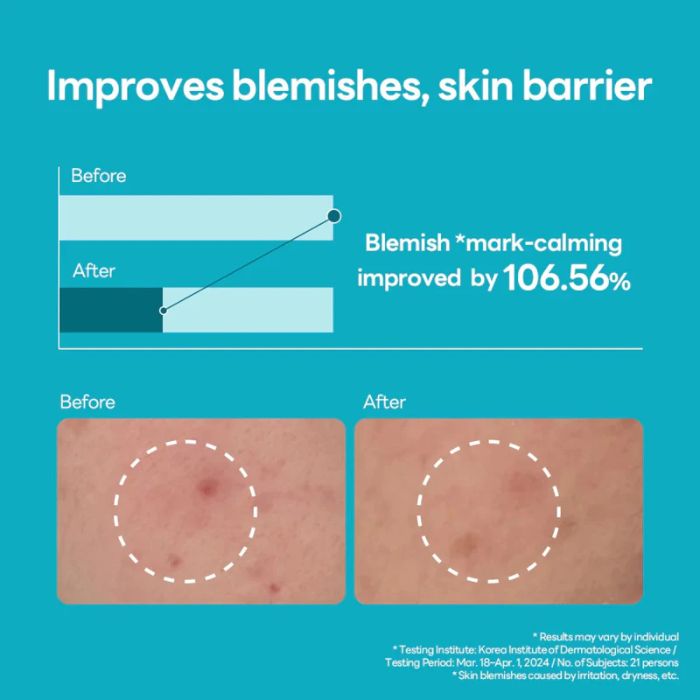 Mediheal Madecassoside Blemish Repair Serum, Brightening and Calming Serum for Post-Acne Marks - 40ml