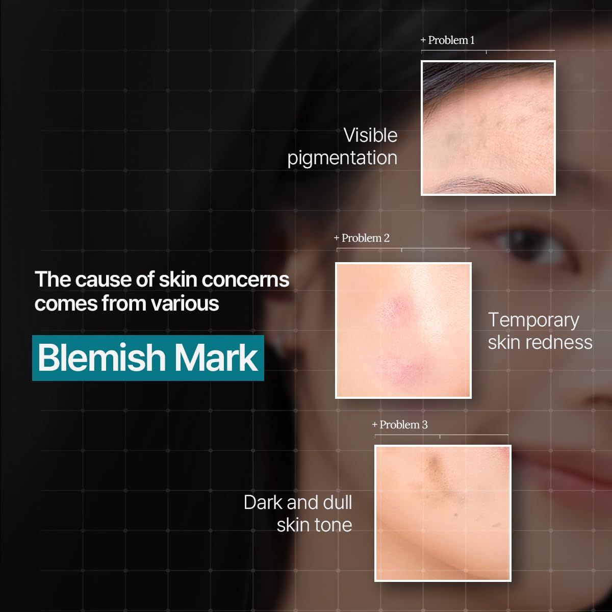 Mediheal Madecassoside, Soothing and Hydrating Sheet Mask for Redness, Blemishes, and Skin Barrier - 24ml
