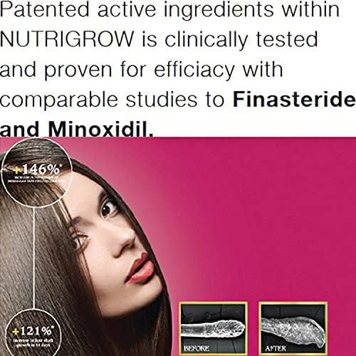 Nutrigrow Anti Hair Loss & Faster Hair Growth Shampoo 4 Dry & Normal Hair 300 ml
