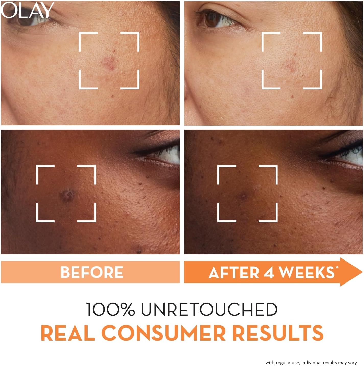 Olay Luminous Vitamin-C Serum 30ml