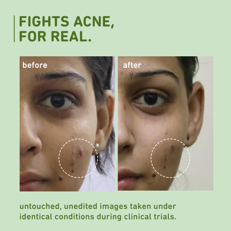 Plum Green Tea Pore Cleansing Face Wash with Glycolic Acid, Oil Control & Anti-Pimple Cleanser, 150ml