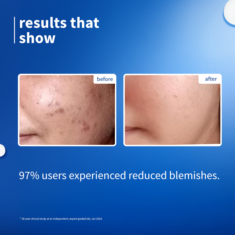 Plum Rice Water & 10% Niacinamide Face Serum for Brightening and Blemish Care, 30ml