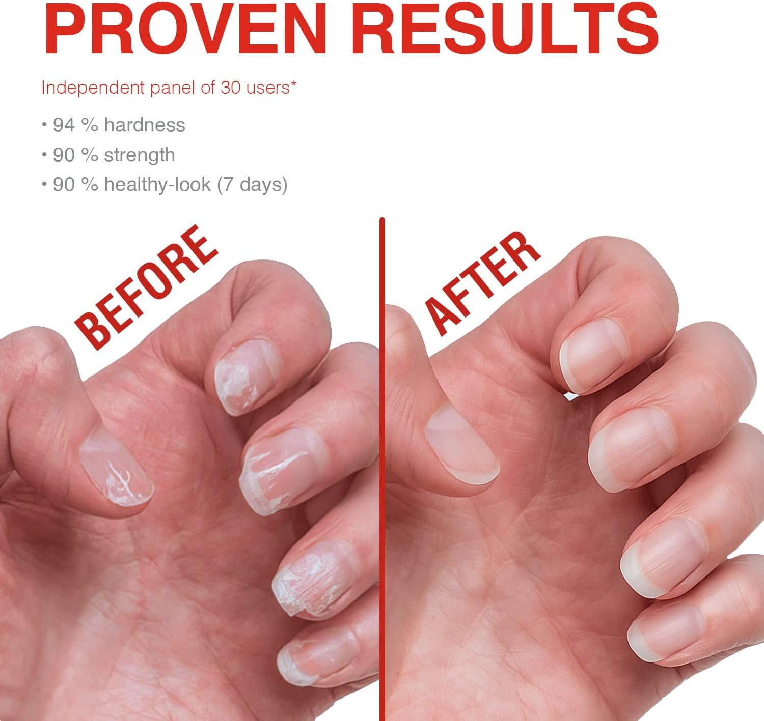 Probelle Nail Strengthener Formaldehyde Free