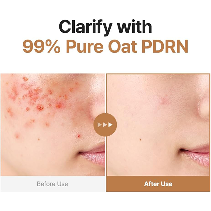 Purito Seoul Vegan Oat PDRN Gentle Refining Toner 200 ml