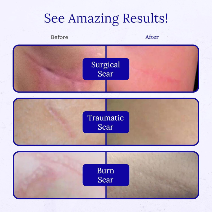 Rejuvasil Silicone Scar Gel 15 ml