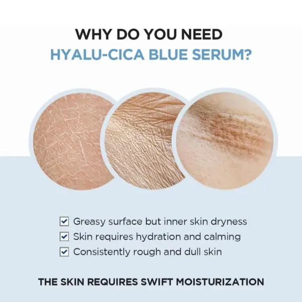 Skin1004 Centella Hyalu-Cica Blue Serum 50ml