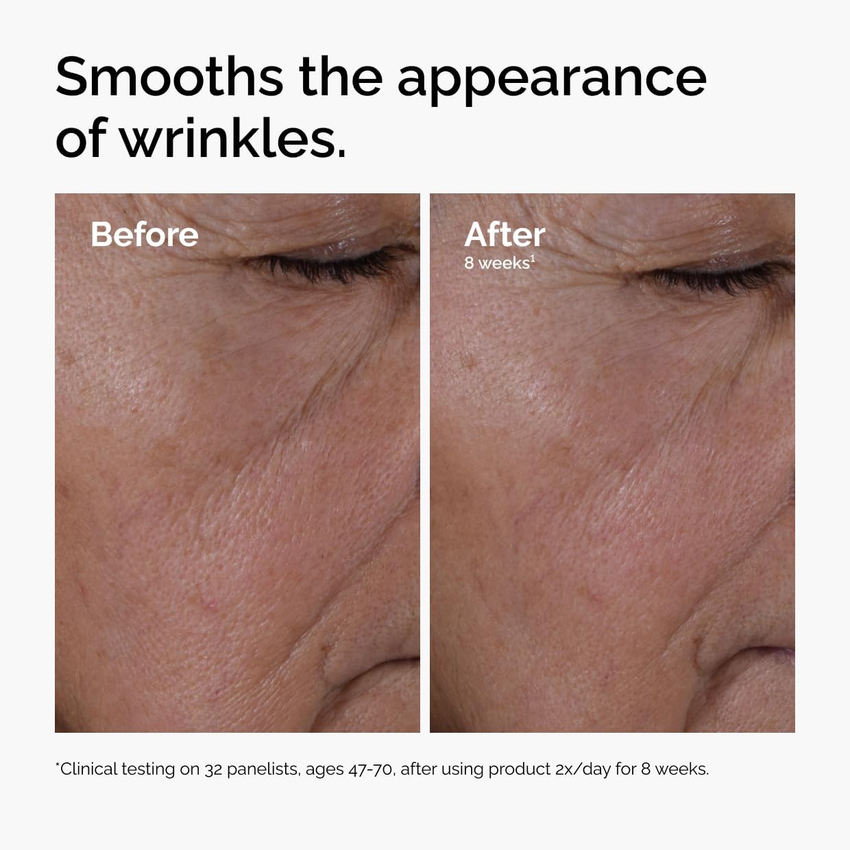 The Ordinary Multi-Peptide + HA, Age-Supporting Serum for Fine Lines, Elasticity and Firmness - 30ml